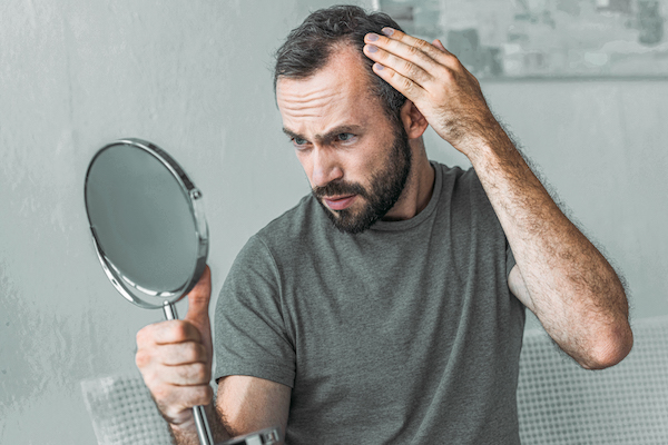 PRP for Hair Loss